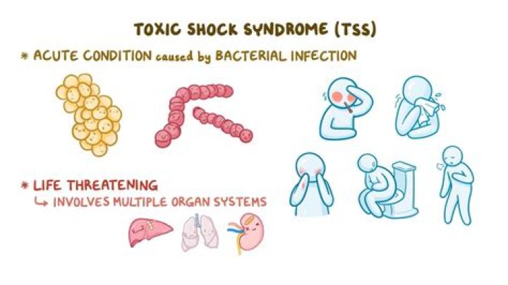 GoFundMe; Heidi Keiser died from Toxic Shock Syndrome –