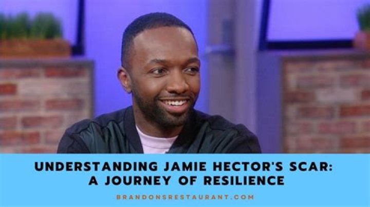 Jamie Hector’s Facial Scar and 9 Other Things To Know About Him