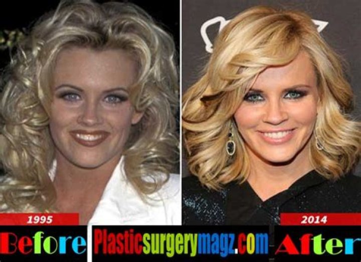 Jenny McCarthy Plastic Surgery: The Truth About Her Cosmetic Enhancements